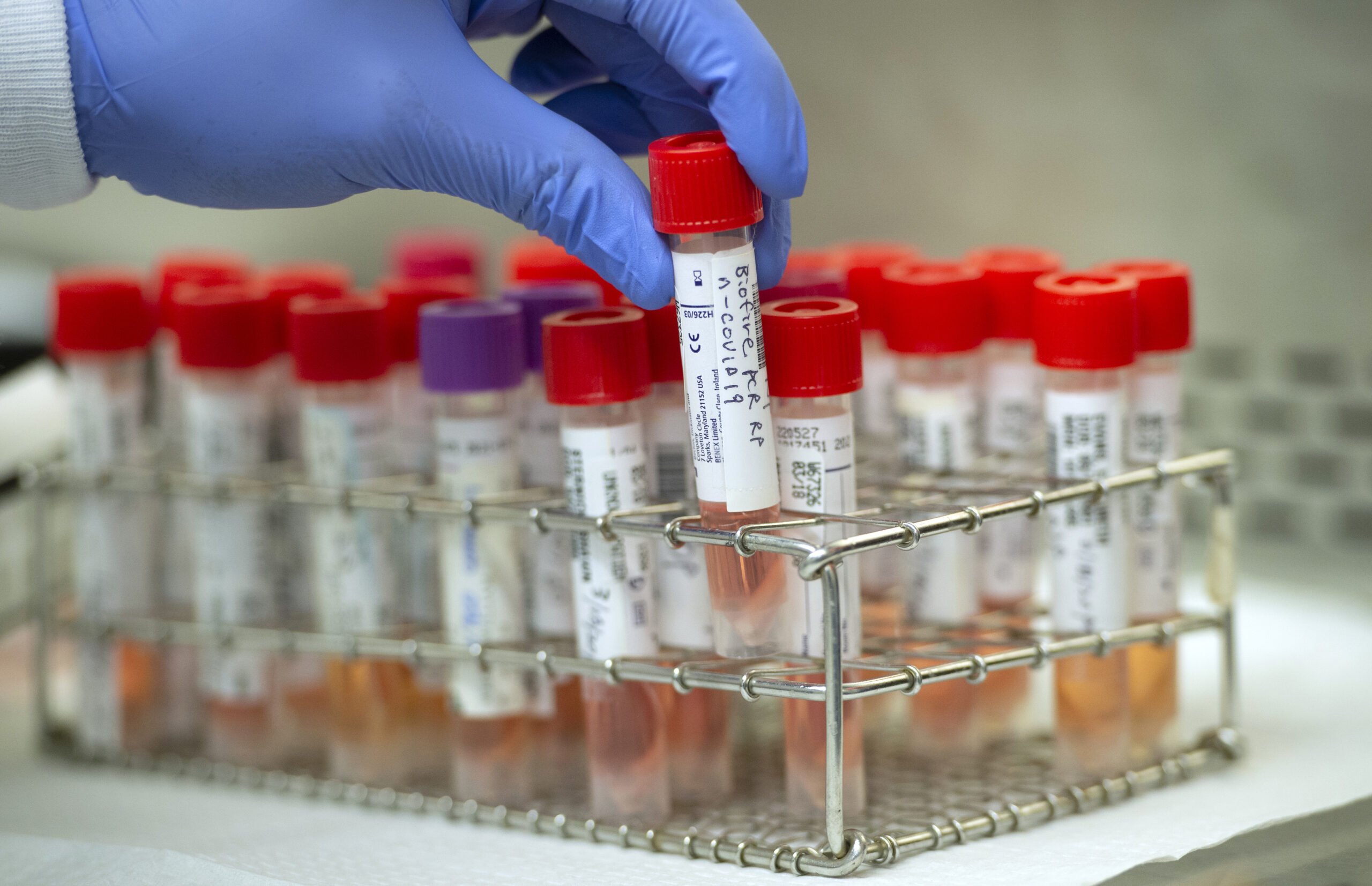 Free COVID-19 Testing Sites